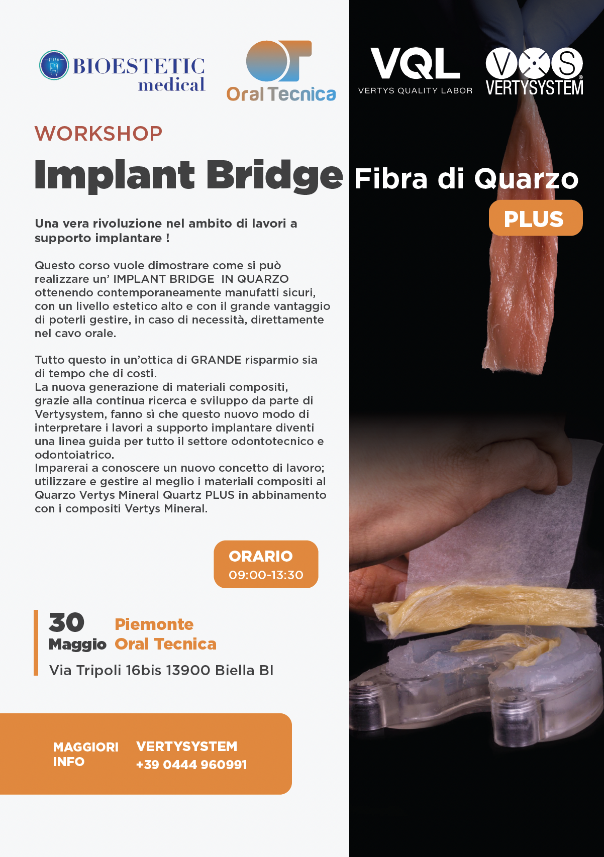 WORKSHOP Implant Bridge Fibra di Quarzo PLUS